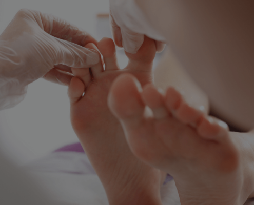 Nagelsvamp bilder