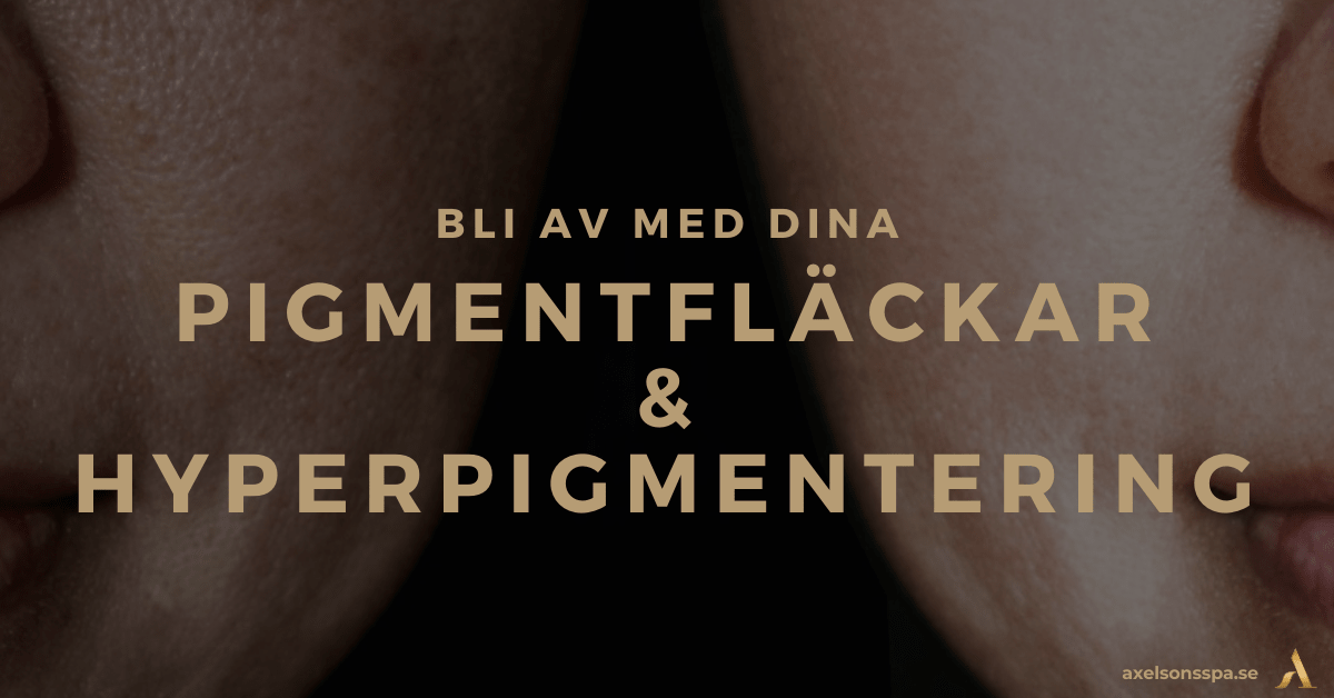 Pigmentfläckar och hyperpigmentering