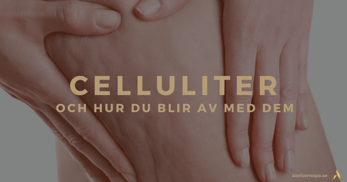 celluliter och hur du blir av med dem