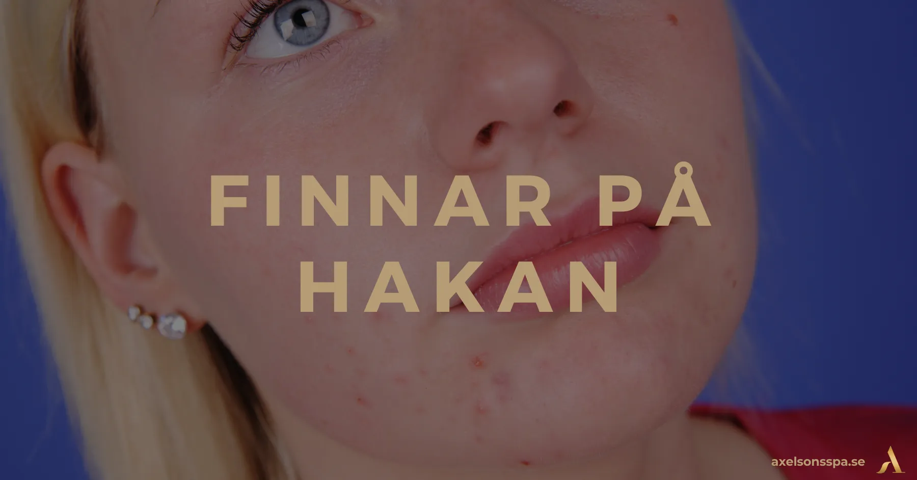 finnar på hakan