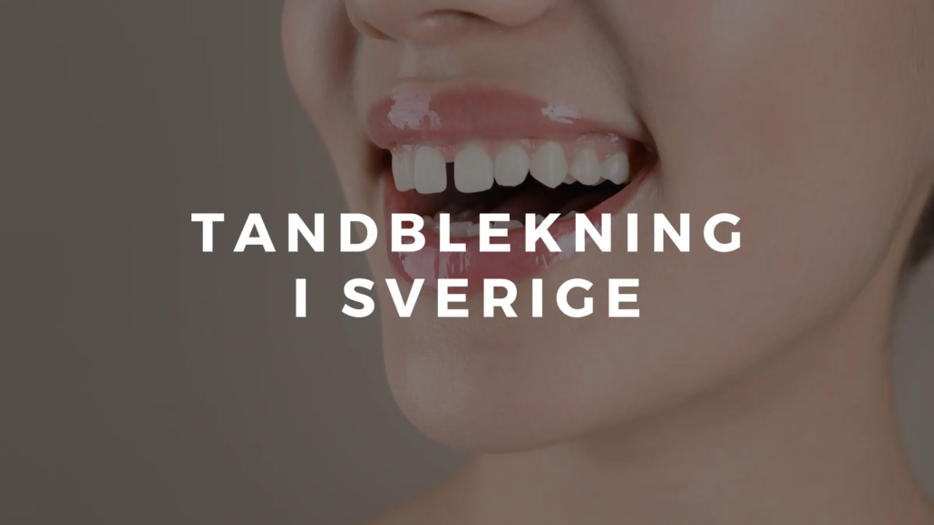 Tandblekning i Sverige